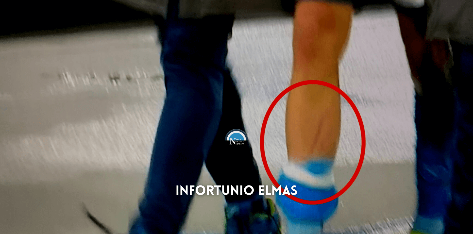 infortunio elmas